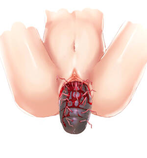 hentai open legs pussy - original, highres, 1girl, bug, guro, nude, pussy, spread legs, spread pussy  - Image View - | Gelbooru - Free Anime and Hentai Gallery