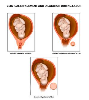 dialated pregnant wifes pussy - Cervix Dilation Chart: Signs, Stages And Procedure To Check