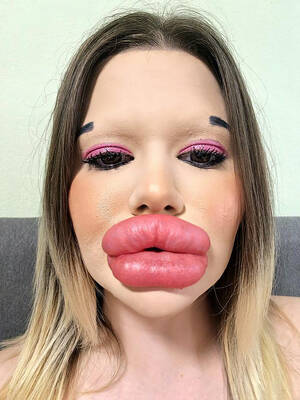 Biggest Lips Porn - I have 'world's biggest lips,' now I'm growing cheekbones