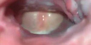 anal internal hentai - Live Action Hentai 2 Internal Anal Creampie View (Shot Inside Ass hole) -  Tnaflix.com