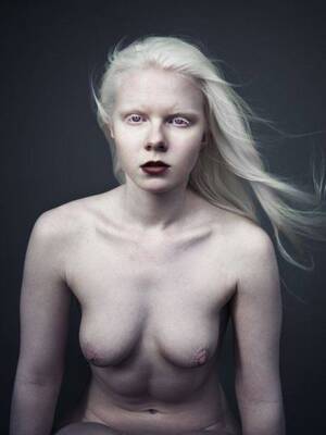 Female Albino Porn - Unknown albino girl : r/Albino_Porn