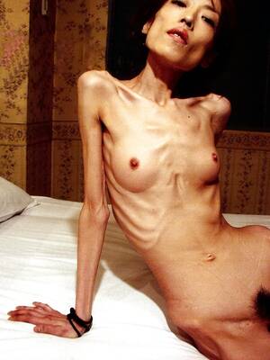 anorexic girl - Anorexic Girls Nude - 70 photos