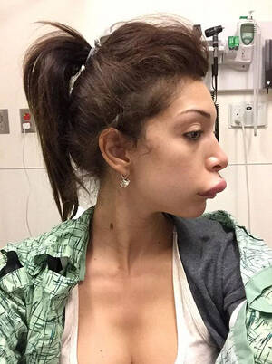 Farrah Abraham Porn Star - When Farrah Abraham's lip job went horribly wrong - India Today