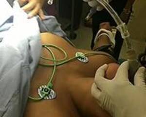 Intubation Porn - Search - intubation | MOTHERLESS.COM â„¢