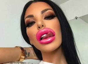 Big Lips Porn Stars - Terrifying pictures show worrying trend of 'porn star lip fillers' - Mirror  Online