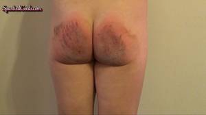 bruised after spankings - Wife fuck hotel slut