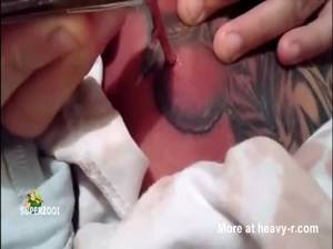 black std pussy - River Of Pus From Infected Tattoo