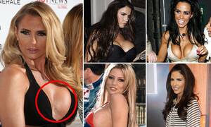 Implants Porn Stars - Katie Price's breast augmentation scars are tragic proof breast implants  are self-harm | Daily Mail Online
