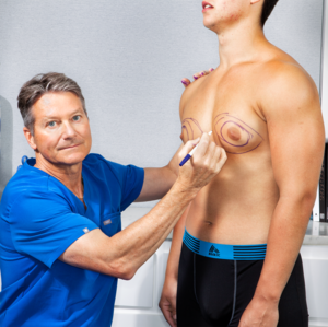 Fat Chub Squeezes Boobs Porn - Dr. Robert Caridi Treats Man Boobs Shame With Gynecomastia Surgery