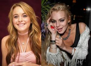 Amanda Bynes Smoking Meth - before and after meth pictures | Lindsay Lohan Before and After Drugs |  Best Drug Rehab