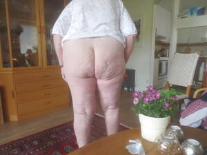 cottage cheese fat ass granny - thumbs.pro : Lovely cottage cheese ass!Find real women like this hereâ€¦