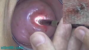 camera is inside - Endoscopic Camera in Cervix watch inside my Womb and Vagina. Inspection  testing exam of wife by extreme doctor gynecologist - XNXX.COM
