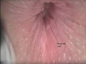 anal abused girl - Sexual Abuse and Assault - Cancer Therapy Advisor