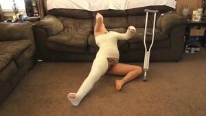 Broken Leg Porn - Free Bad girl, with her broken arm and leg is walking around the house,  without panties Porn Video HD
