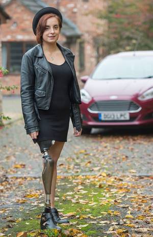 Disabled Girl Amputee Porn - Girl who had leg amputated told she's not 'disabled enough' for Motability  car