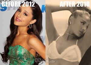 Ariana Grande Porn Tits - Ariana Grande Plastic Surgery REVEALED! Then And Now