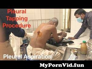 Icdn Ped Porn - Pleural tapping procedure || pleural fluid aspiration || pleural effusion  from icdn ped Watch Video - MyPornVid.fun