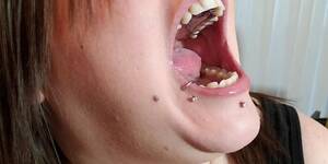 False Teeth - Young gal wearing partial dentures - Tnaflix.com