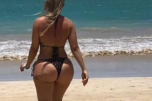bubble butt brazilian beach sex - I hated my Brazilian butt lift â€” and paid $25,000 to have it reversed