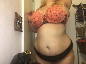 fat teen stretch marks - Real BBW proud of her natural, Motherly stretch marks.