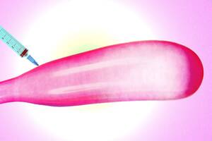 Huge Dick Porn Stars - How Injectable Fillers Became the Biggest Thing in Penis Enlargement | GQ