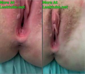 Nude Albino Girl Porn - Shy Albino Girl Love getting her Pussy Destroyed By Big Gbola | LEAKTUBE