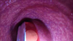 internal anal camera - Internal Camera Deep Can Insertion - xxx Mobile Porno Videos & Movies -  iPornTV.Net