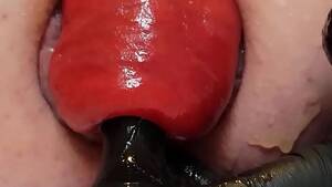 longest anal prolapse - Contender For Biggest Prolapse (Male Warning!) - XVIDEOS.COM