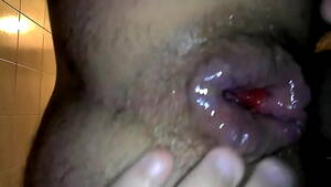 anale dilatation - Dilatation Anal Ã  Lyon - XVIDEOS.COM