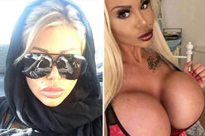 Iran Porn Star Nose Job - Brit porn star angers Muslims after getting nose job in Iran | Daily Star