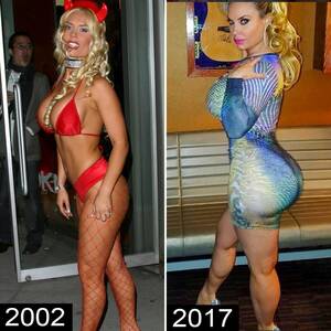 ass implants - Before-and-After Pics of Celebrities With Rumored Butt Implants