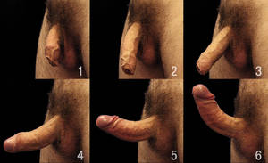 average penis gallery - The development of a penile erection, also showing the foreskin gradually  retracting over the glans. See also: Commons image gallery