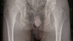 Deep Anal Sex X Ray - More than Skin Deep - an X-ray View of my Dick!! - Pornhub.com