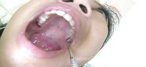 Mouth Fetish Porn - Mouth Fetish - Lucky Starr's Dental Exam
