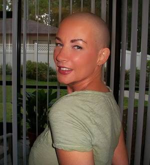 Loses Virginity Porn Natasha Portman - This is a picture after I lost my hair due to BC treatment 08/2010