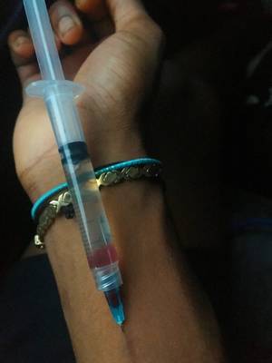 needle injection - First IV Oxycoodone in a couple months (needle porn) ...