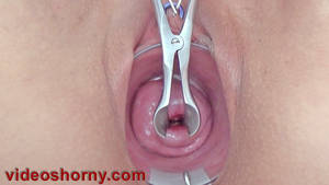 extreme speculum sex - Extreme cervix play video with insertion of a metal chain of 55 cm (22  inch) long fully inside uterus. Extreme gape with a speculum with long  blades ...