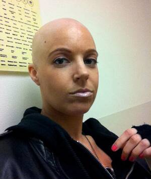 Bald Female Porn Stars - Pictured as her fans could never have imagined, the bald-headed porn star  battling cancer at the age of 30 - TRPWL