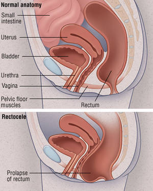 Intestine Bulge Porn - at anus bulge opening of