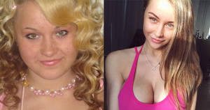 Dolly Supermodel Porn - Girl Goes From Ugly Duckling To Stunning Supermodel supermodel beautiful  foreign russia russian weird model weight