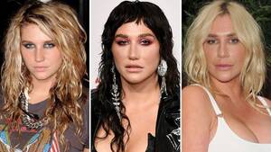 kesha upskirt - Kesha Transformation: See How the 'Tik Tok' Singer Has Changed | Life &  Style