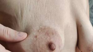 floppy mature tit stretch marks - Closeup Saggy Tits with Stretch Marks - Pornhub.com