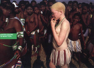 Nude Albino Girl Porn - tribalfav: lafemmenue: Albino Girl for United Colors of Benetton (via  pilipi) Tumblr Porn