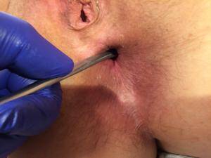 needle fetish anal - Search - rectal needle play | MOTHERLESS.COM â„¢