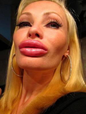 big fake lips - She went too far with these lips !!