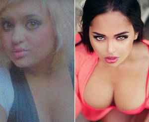 Iran Porn Star Nose Job - Nita Kuzmina before and after surgery