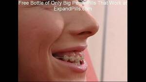facial teen anal braces - Sandra Skinny Teen Braces Anal Facial - XVIDEOS.COM
