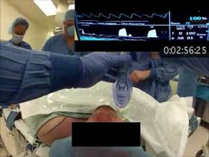 Intubation Porn - Optical stylet intubations two ways by Master DuCanto | Prehospital and  Retrieval Medicine - THE PHARM dedicated to the memory of Dr John Hinds