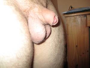 micro penis anal - photo of a micropenis after penis enlargement surgery