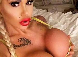 Iran Porn Star Nose Job - British porn star @CandyCharms69 sparks outrage online after going to Iran  for a nose job